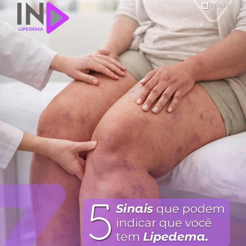 Post Instagram Fisio In 5